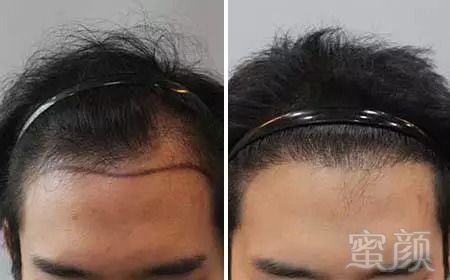 https://img.miyanlife.com/mnt/timg/180916/12350VY9-7.jpg