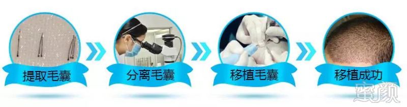 https://img.miyanlife.com/mnt/timg/180916/12350W0X-4.jpg