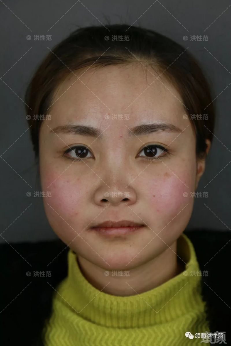 https://img.miyanlife.com/mnt/timg/180916/12351BT7-0.jpg