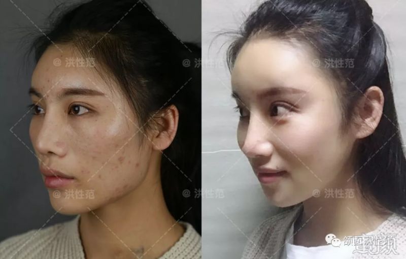 https://img.miyanlife.com/mnt/timg/180916/12351L035-4.jpg