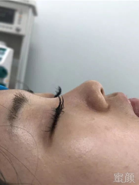 https://img.miyanlife.com/mnt/timg/180916/123A64158-0.jpg