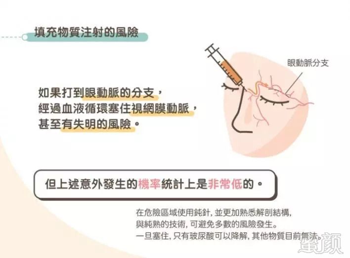 https://img.miyanlife.com/mnt/timg/180916/123G3KB-6.jpg