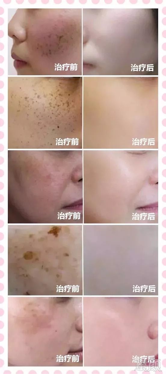 https://img.miyanlife.com/mnt/timg/180916/13422330K-5.jpg
