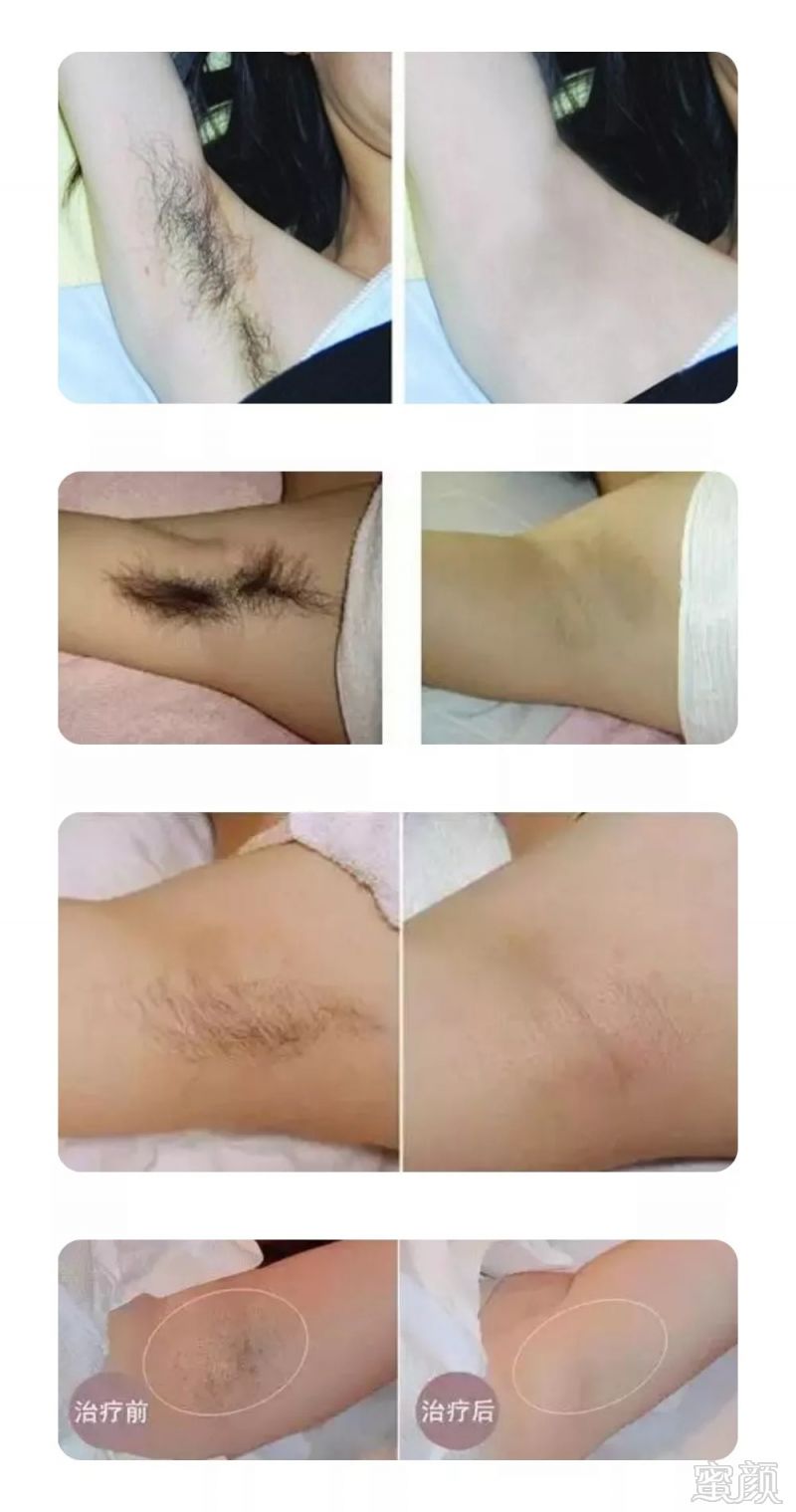 https://img.miyanlife.com/mnt/timg/180916/134K05404-14.jpg