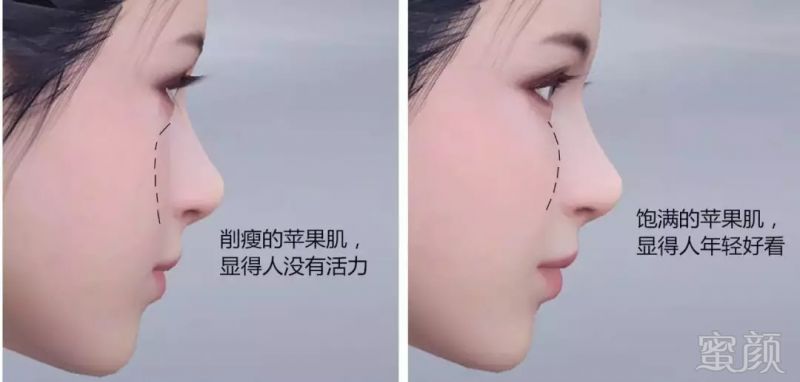 https://img.miyanlife.com/mnt/timg/180916/1405553111-7.jpg