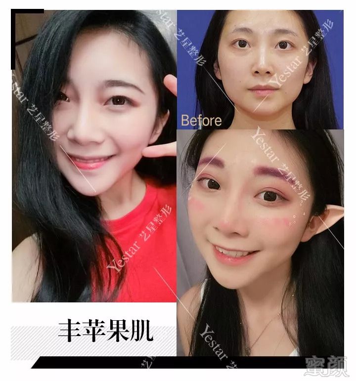 https://img.miyanlife.com/mnt/timg/180916/1405563610-10.jpg