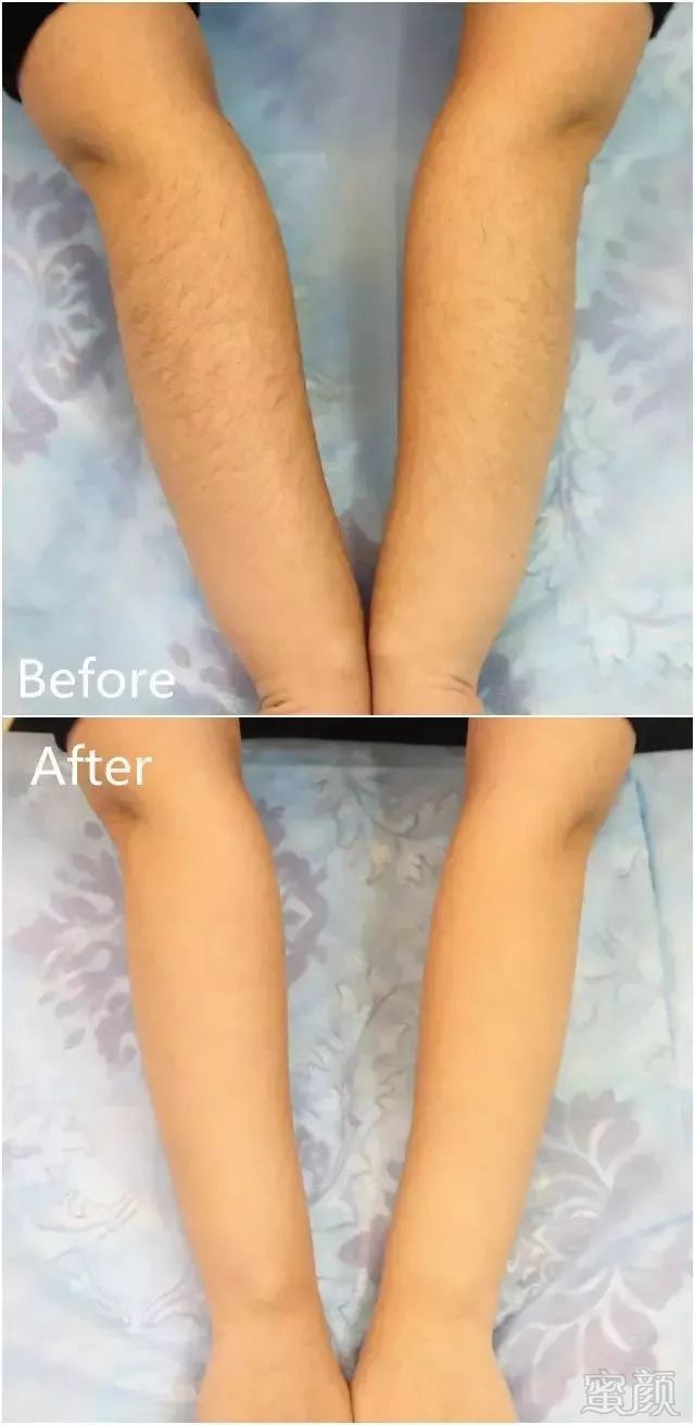 https://img.miyanlife.com/mnt/timg/180916/140Z941K-7.jpg