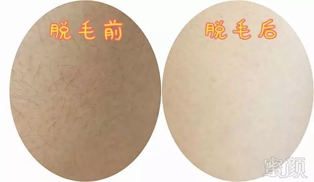 https://img.miyanlife.com/mnt/timg/180916/141011D51-11.jpg