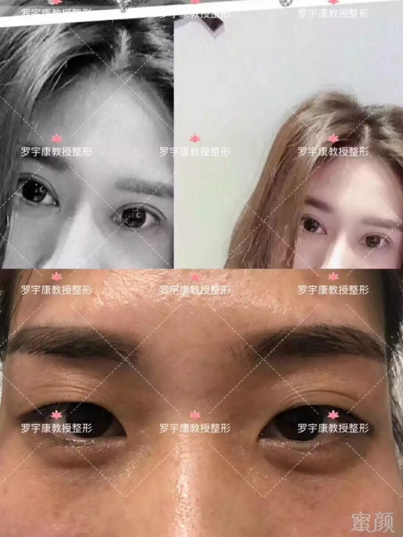 https://img.miyanlife.com/mnt/timg/180916/1420591337-5.jpg