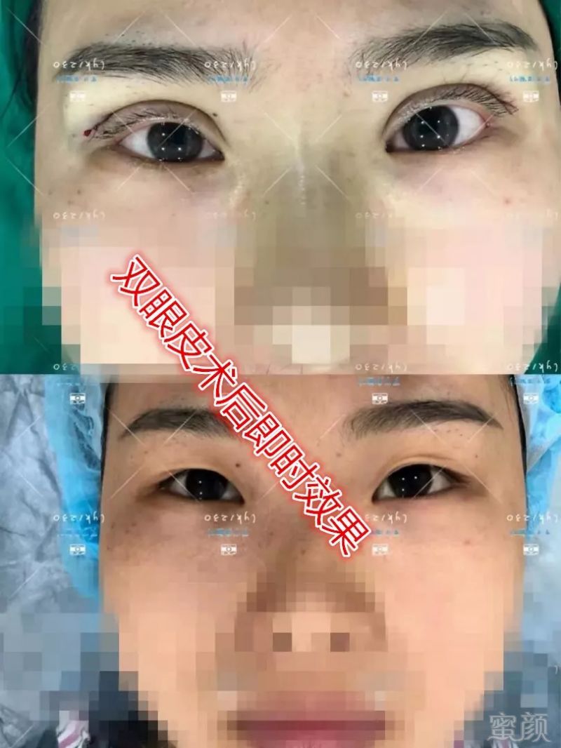 https://img.miyanlife.com/mnt/timg/180916/142103A16-12.jpg