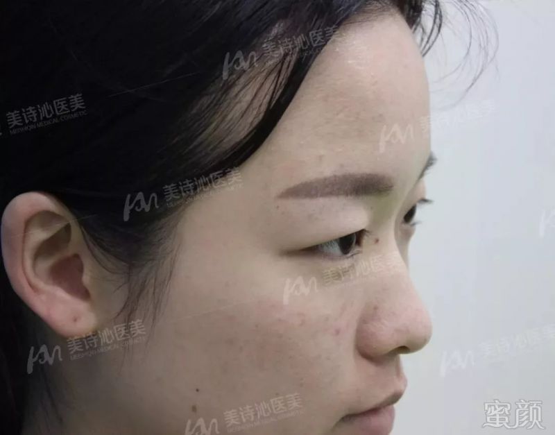 https://img.miyanlife.com/mnt/timg/180916/1429291G5-13.jpg