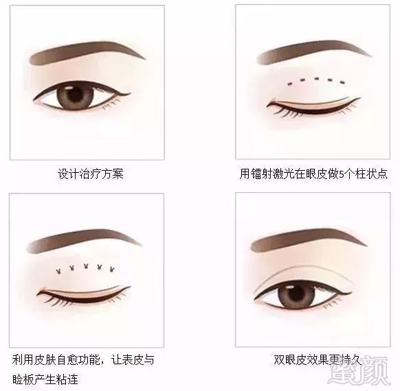 https://img.miyanlife.com/mnt/timg/180916/14292U547-5.jpg
