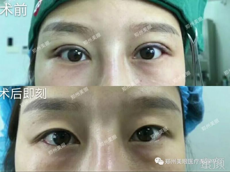 https://img.miyanlife.com/mnt/timg/180916/1429545022-0.jpg