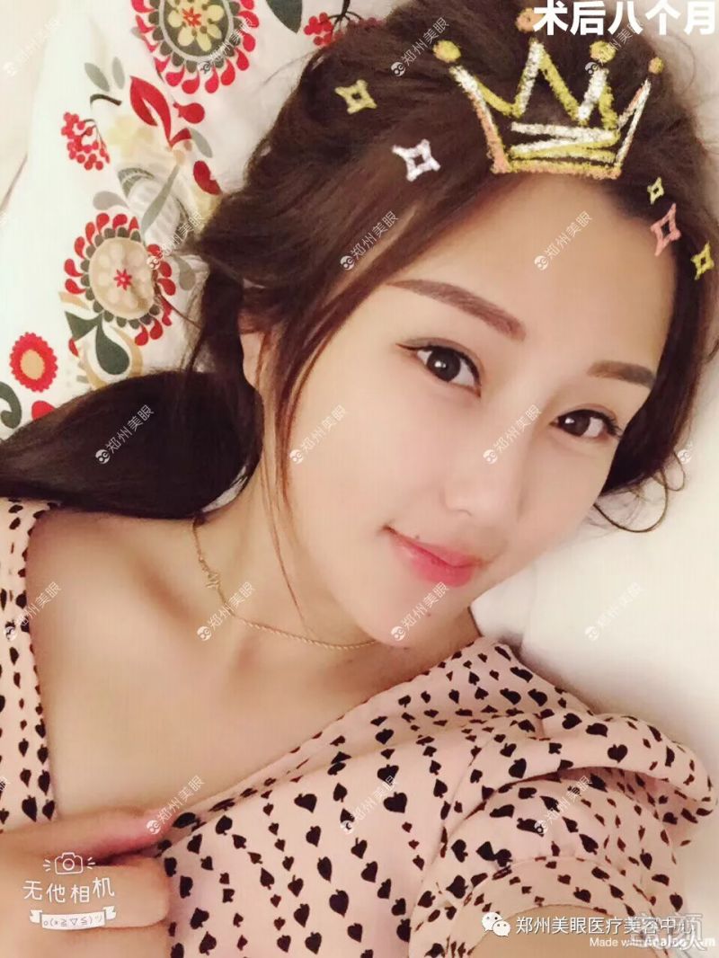 https://img.miyanlife.com/mnt/timg/180916/14295A0K-8.jpg