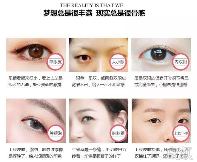 https://img.miyanlife.com/mnt/timg/180916/14300530C-1.jpg