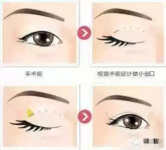 https://img.miyanlife.com/mnt/timg/180916/1430054I1-5.jpg