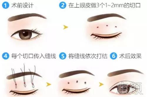 https://img.miyanlife.com/mnt/timg/180916/14300BW9-6.jpg