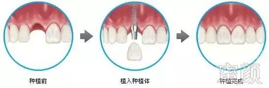 https://img.miyanlife.com/mnt/timg/180917/10493455S-2.jpg