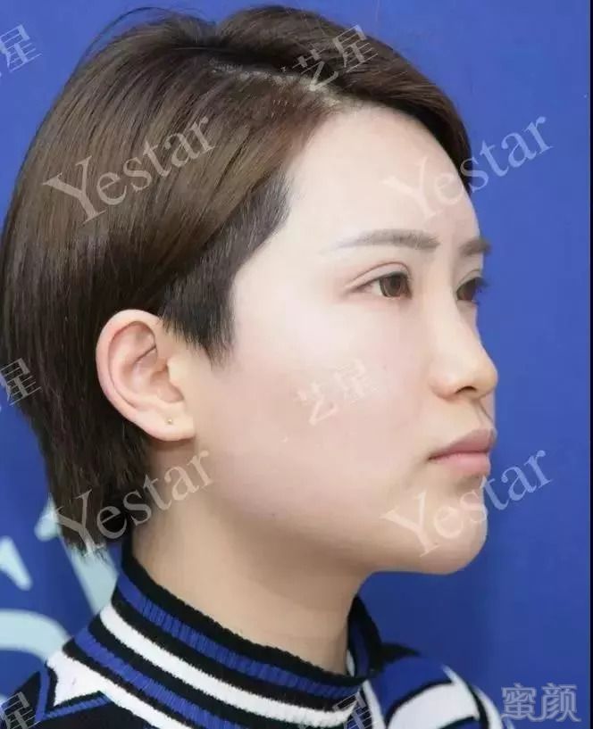 https://img.miyanlife.com/mnt/timg/180917/105433I47-3.jpg