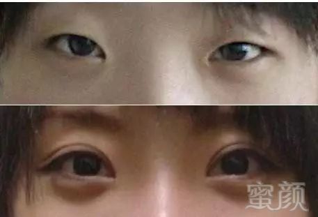 https://img.miyanlife.com/mnt/timg/180917/1115595U6-4.jpg