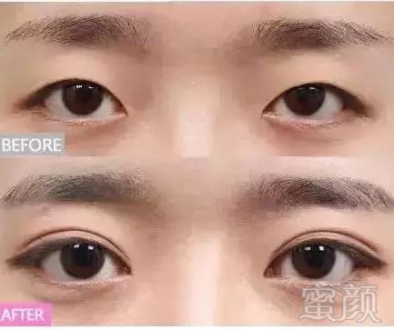 https://img.miyanlife.com/mnt/timg/180917/11155R320-2.jpg