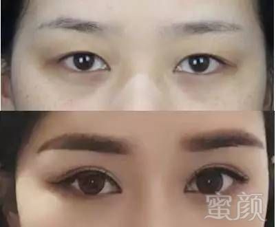 https://img.miyanlife.com/mnt/timg/180917/11155R628-0.jpg