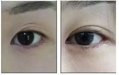 https://img.miyanlife.com/mnt/timg/180917/11155U5O-3.jpg