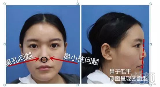 https://img.miyanlife.com/mnt/timg/180917/1119592408-2.jpg