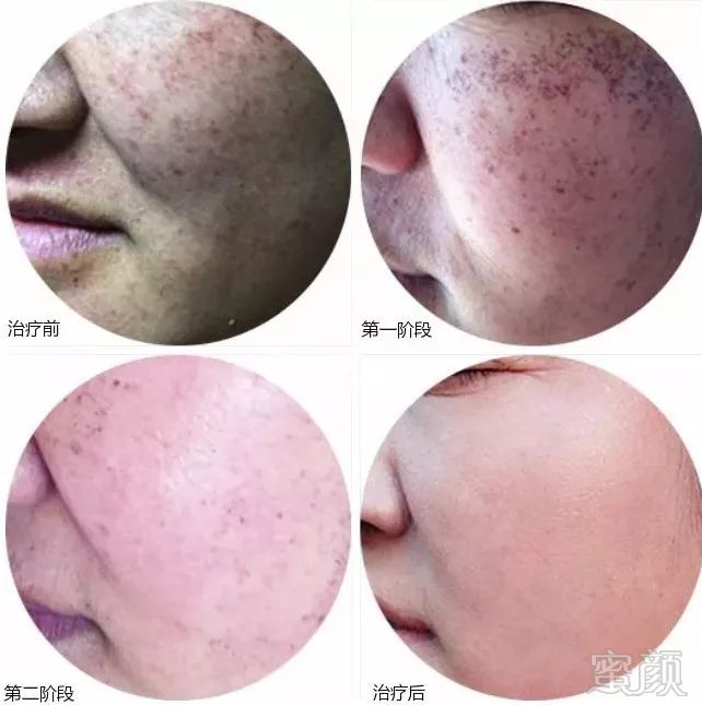https://img.miyanlife.com/mnt/timg/180917/111A1B03-8.jpg