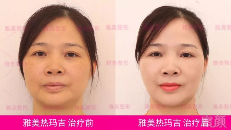https://img.miyanlife.com/mnt/timg/180917/11225T510-3.jpg