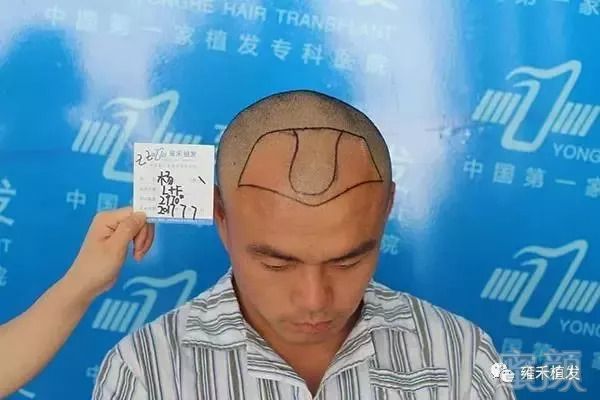 https://img.miyanlife.com/mnt/timg/180917/1211091922-3.jpg