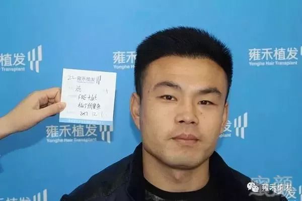 https://img.miyanlife.com/mnt/timg/180917/1211093263-6.jpg