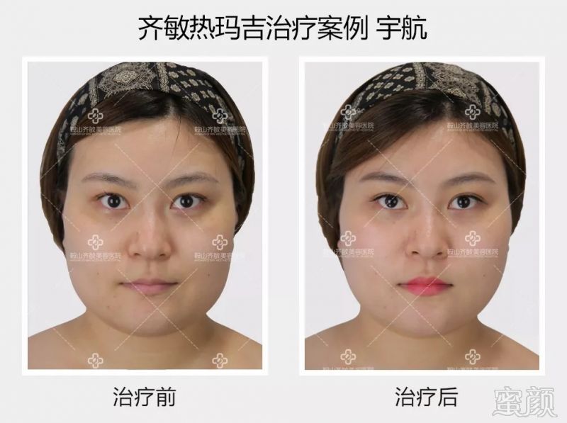 https://img.miyanlife.com/mnt/timg/180917/1236393Y3-8.jpg