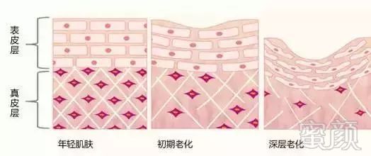 https://img.miyanlife.com/mnt/timg/180917/12363SZ4-1.jpg