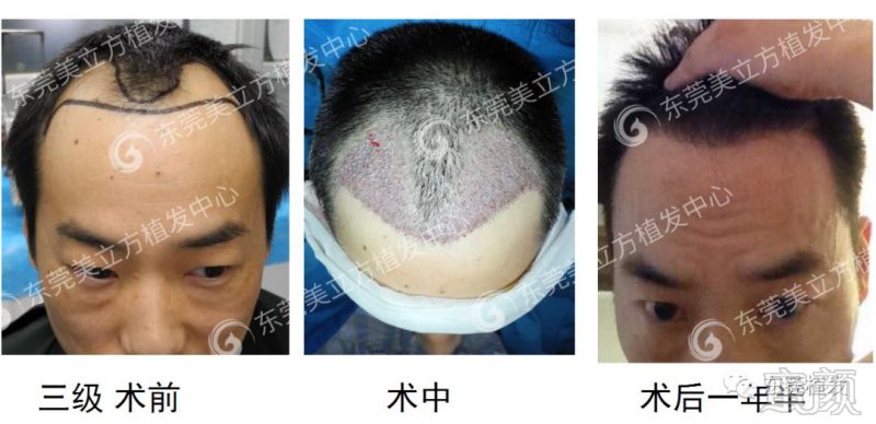 https://img.miyanlife.com/mnt/timg/180918/1056255Z6-3.jpg