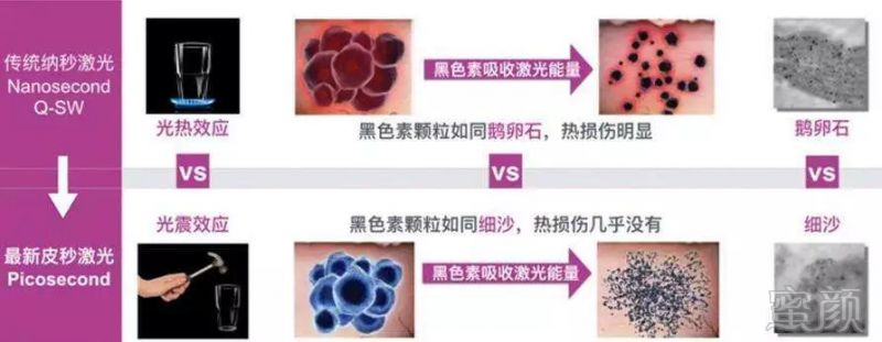 https://img.miyanlife.com/mnt/timg/180918/110K62Z1-2.jpg