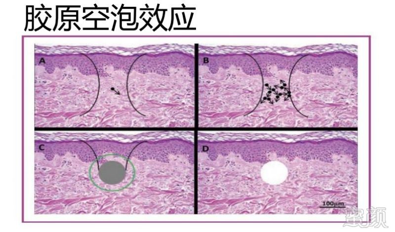 https://img.miyanlife.com/mnt/timg/180918/110K63M0-6.jpg