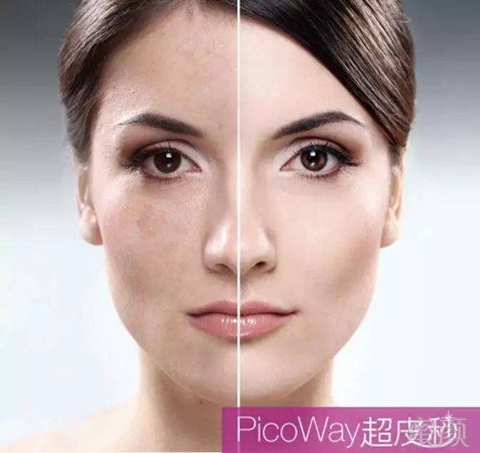 https://img.miyanlife.com/mnt/timg/180918/110K64b9-1.jpg