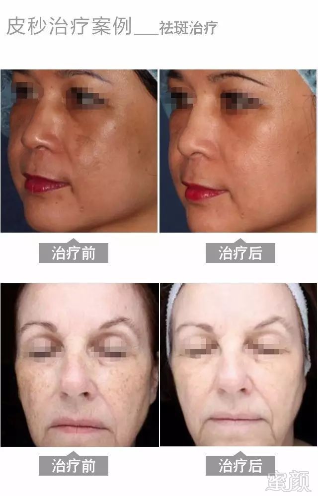 https://img.miyanlife.com/mnt/timg/180918/110KM331-9.jpg