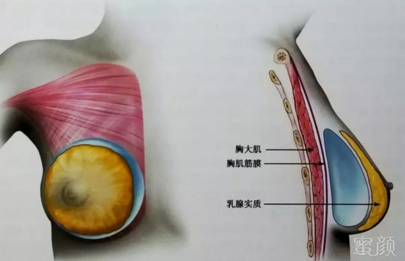 案例图片