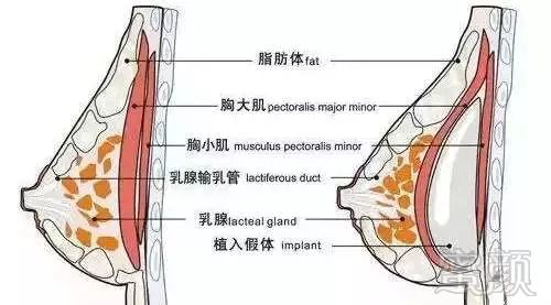 案例图片