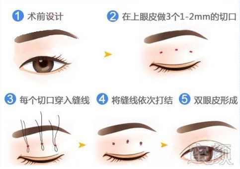https://img.miyanlife.com/mnt/timg/180918/12004B225-8.jpg