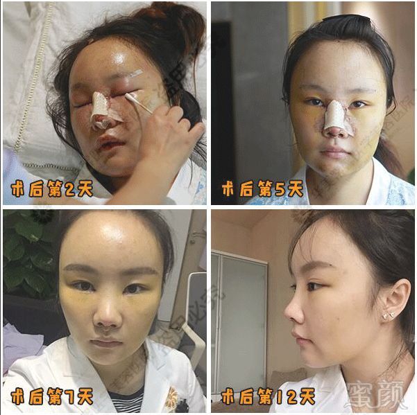 https://img.miyanlife.com/mnt/timg/180918/120A23632-1.jpg