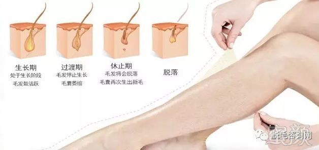 案例图片