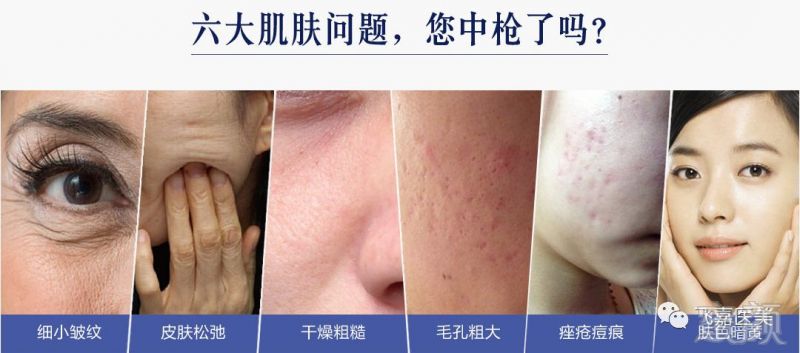 https://img.miyanlife.com/mnt/timg/180918/121FQ006-0.jpg