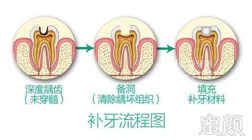 案例图片