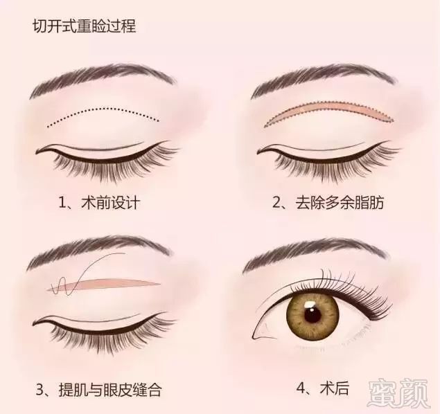 https://img.miyanlife.com/mnt/timg/180918/124Z32640-3.jpg