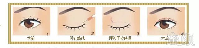 https://img.miyanlife.com/mnt/timg/180918/124Z33146-2.jpg