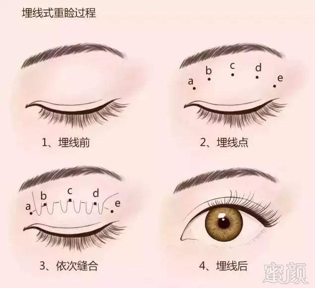 https://img.miyanlife.com/mnt/timg/180918/124Z340O-1.jpg
