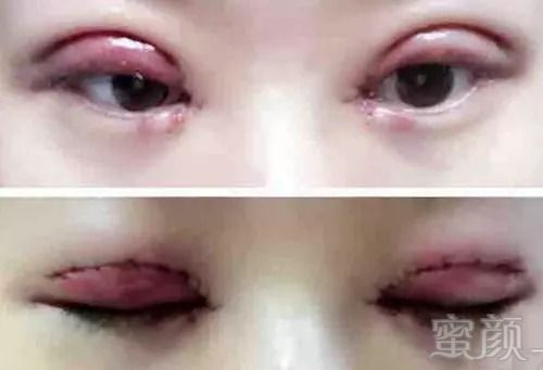 https://img.miyanlife.com/mnt/timg/180918/125430C15-4.jpg